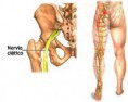 /album/envolvimentos-crioterapia/imagescavra7on-jpg/